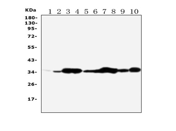 Western Blot of Anti-Annexin V